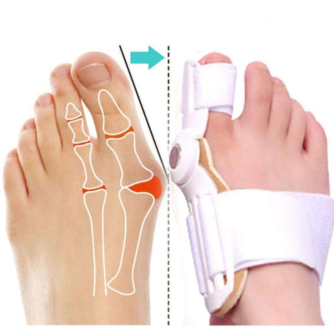 AlignaStep™ — End Bunion Pain and Step Confidently into Comfort