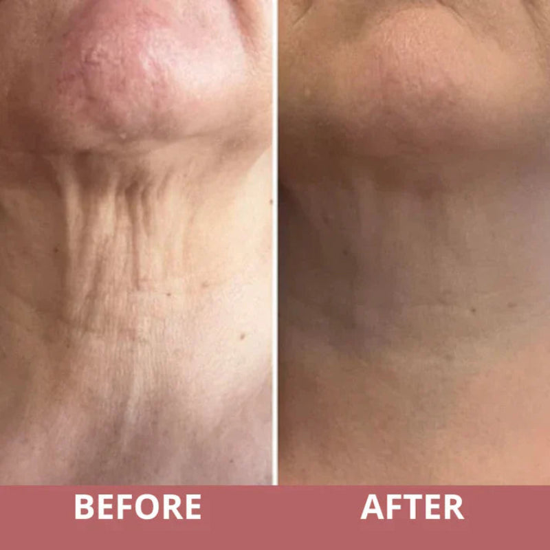 NeckaLift™ — Sculpt a Youthful, Radiant Neck You Can Flaunt Every Day