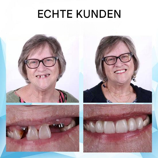 DentaFlex™ – Your Perfect Smile Right Away