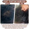 (1+1 FREE) Caremey™ — Transform Thinning Hair into a Bold, Thick Crown in Just 14 Days