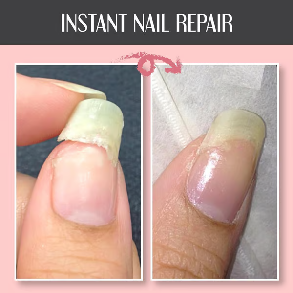 NailCure™ - Repair gel for instant nail healing