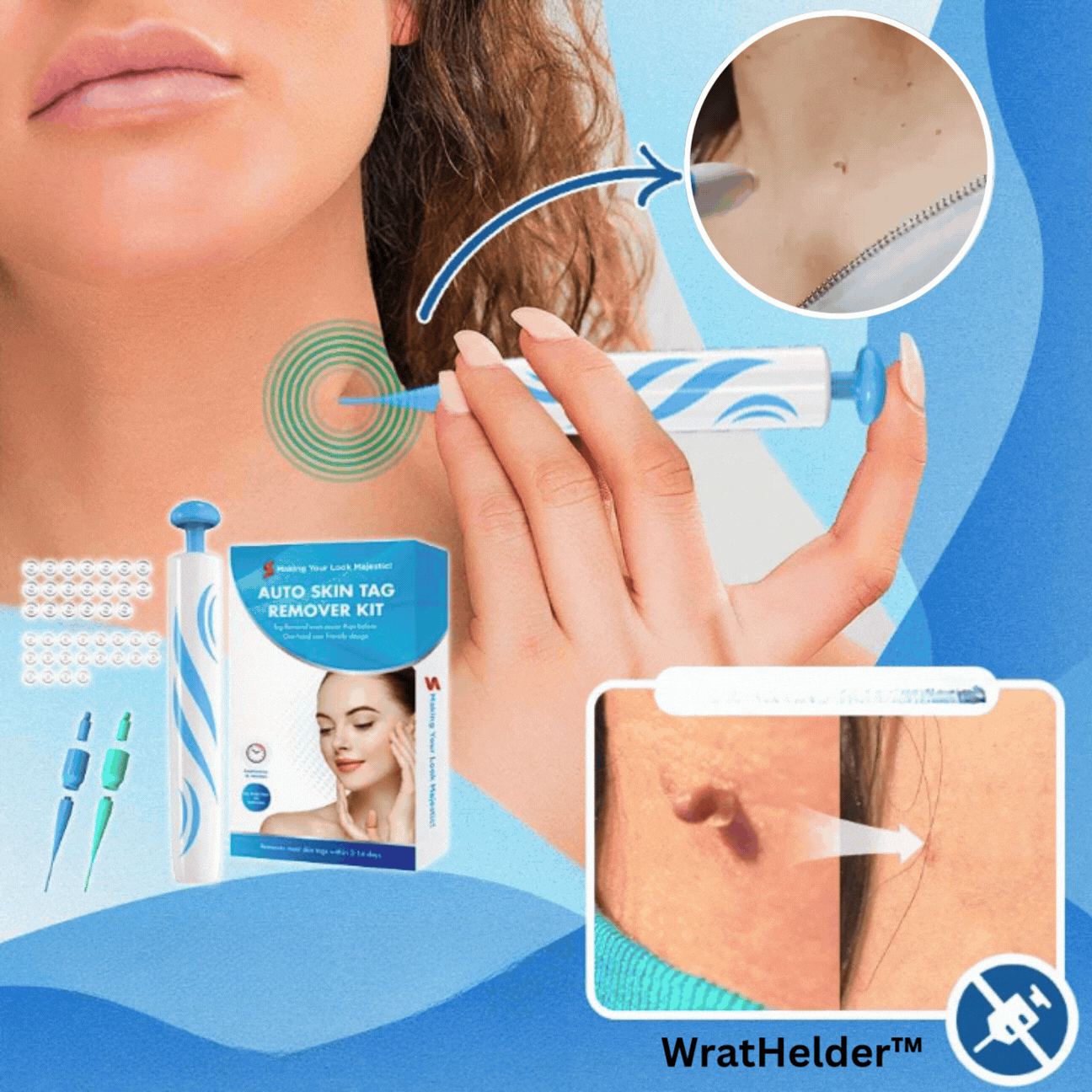 ClearSkinX™ — Zap Warts Fast and Unleash Your Radiant, Head-Turning Skin (FULL KIT)