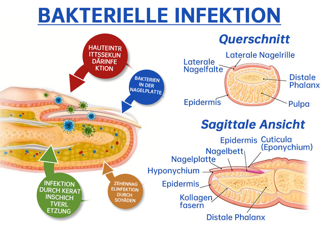 NailEssence™ | Fungus Laser Therapy Device