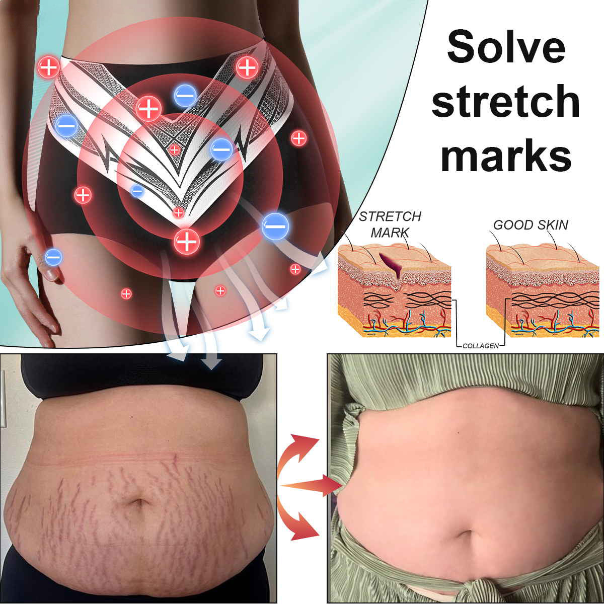 GlacioShape™ — Cozy Heat That Melts Fat, Smooths Skin & Frees You from Aches