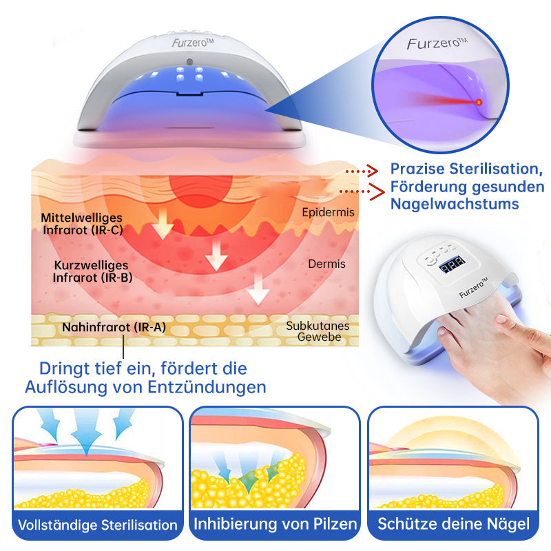 NailEssence™ | Fungus Laser Therapy Device