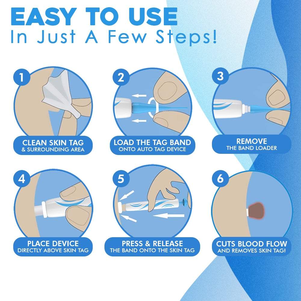 ClearSkinX™ — Zap Warts Fast and Unleash Your Radiant, Head-Turning Skin (FULL KIT)