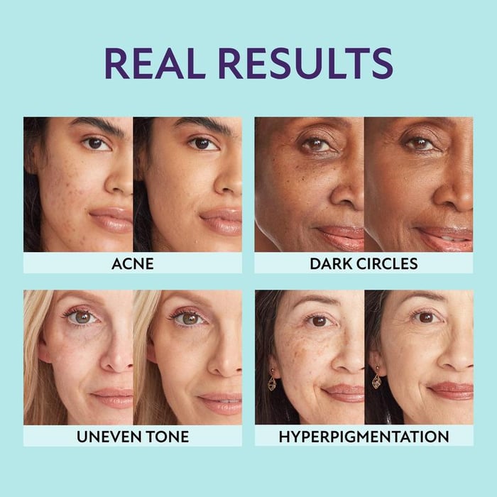 AquaLustre™ - 3-in-1 Hydrating Concealer