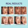 AquaLustre™ - 3-in-1 Hydrating Concealer