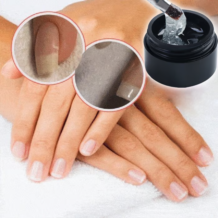 NailCure™ - Repair gel for instant nail healing