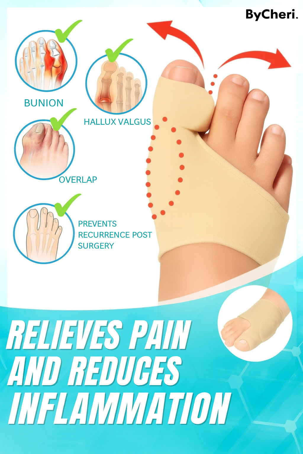 (1 + 1 ) FREE TODAY | ToeAlign™ | Dr.Fit Bunion Correction Sleeve