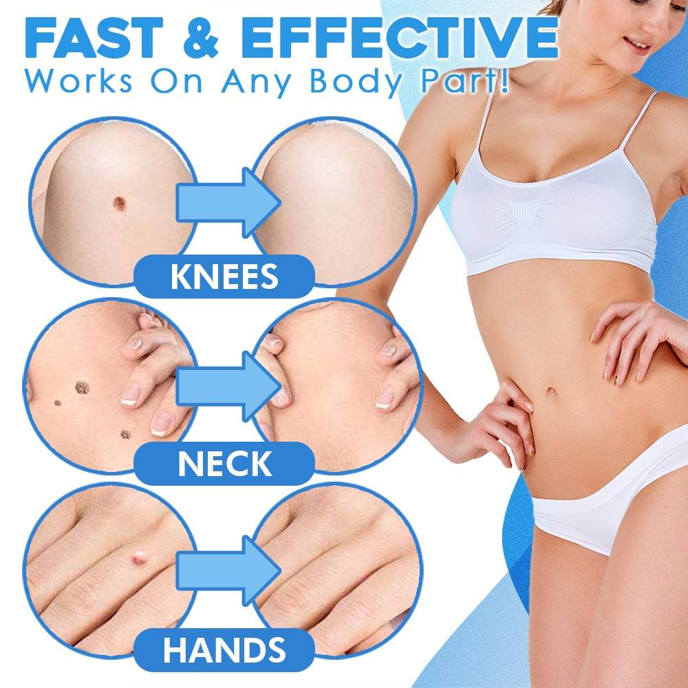FlawFix™ Skin Tag Removal Kit