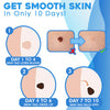 FlawFix™ Skin Tag Removal Kit