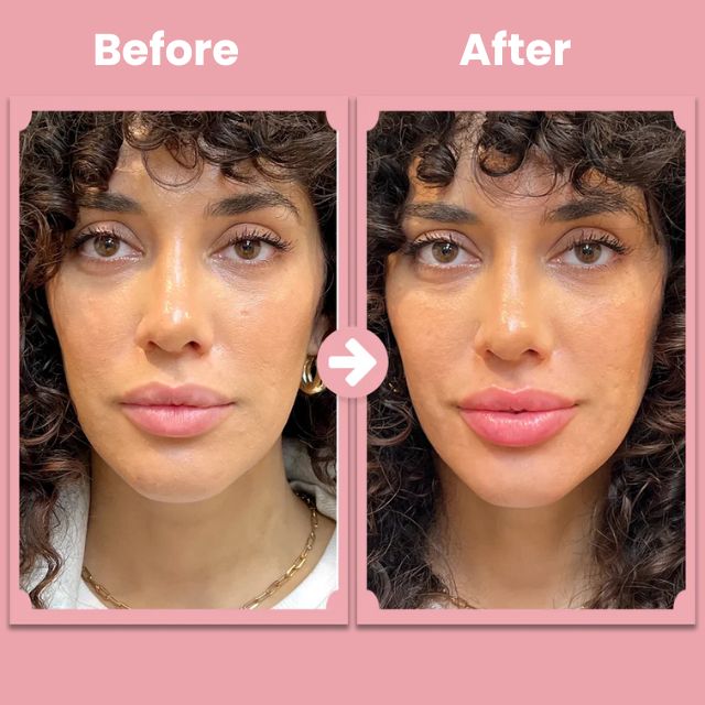 LushPout™ — Ignite Your Natural Collagen for Soft, Fuller Lips Instantly