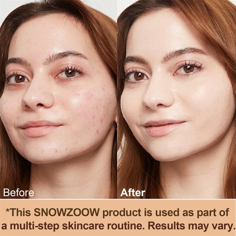 ToneLume™ - 4-in-1 Adaptive Foundation