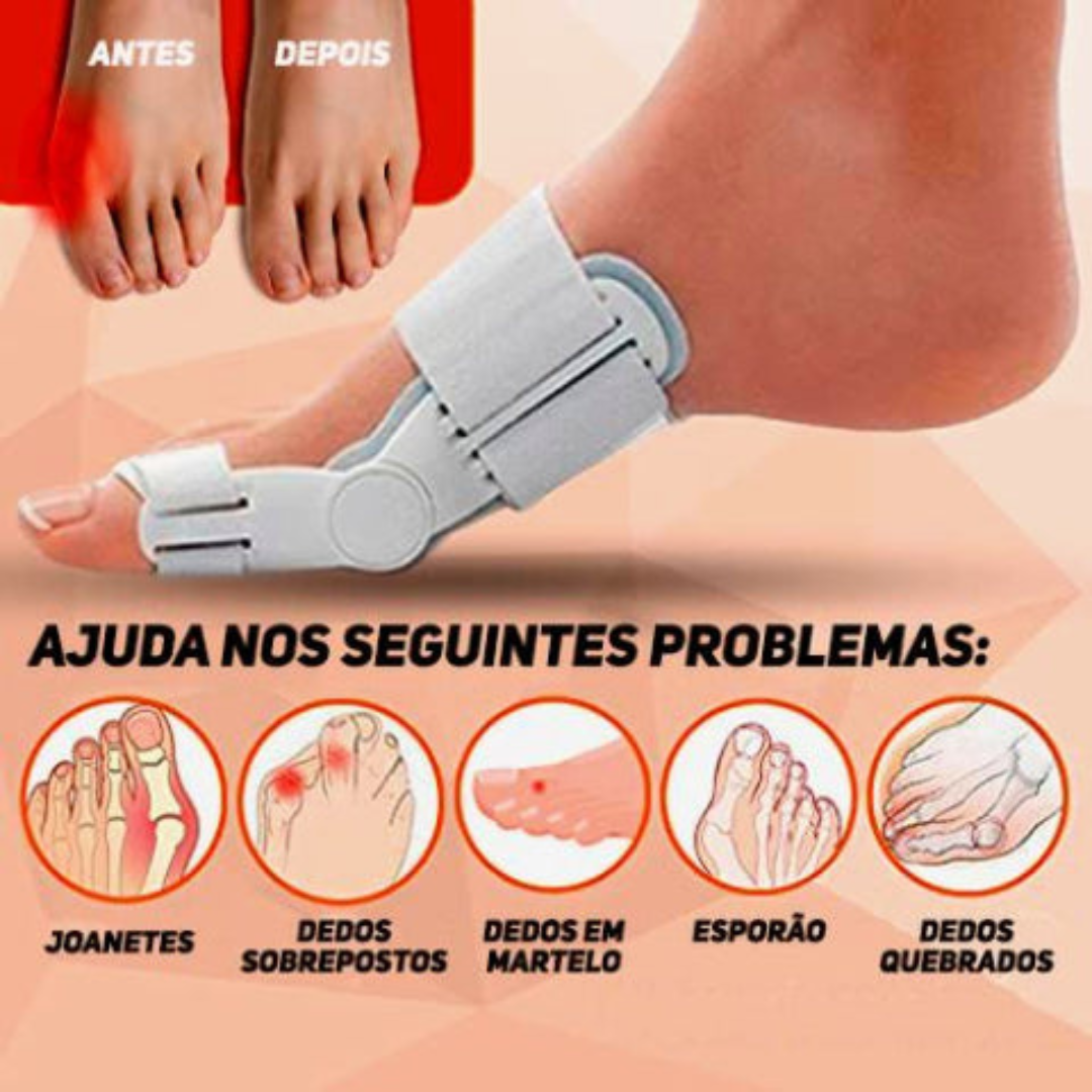 AlignaStep™ — End Bunion Pain and Step Confidently into Comfort
