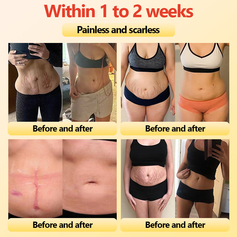 GlacioShape™ — Cozy Heat That Melts Fat, Smooths Skin & Frees You from Aches