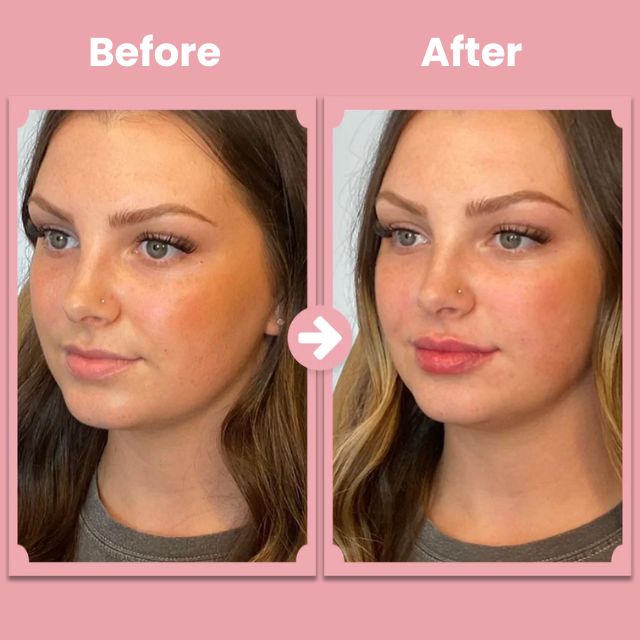 LushPout™ — Ignite Your Natural Collagen for Soft, Fuller Lips Instantly